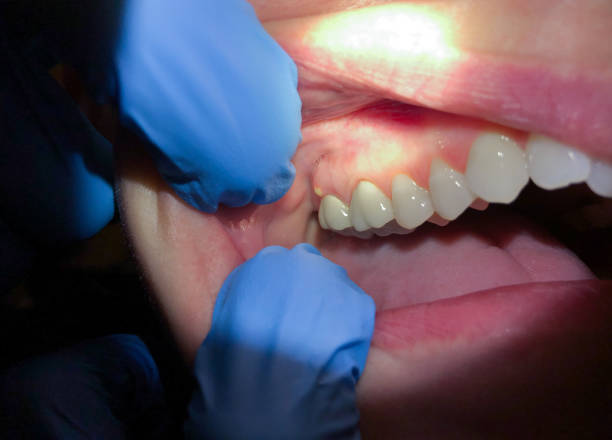 Best Walk-In Emergency Dentist in Hazen, AR