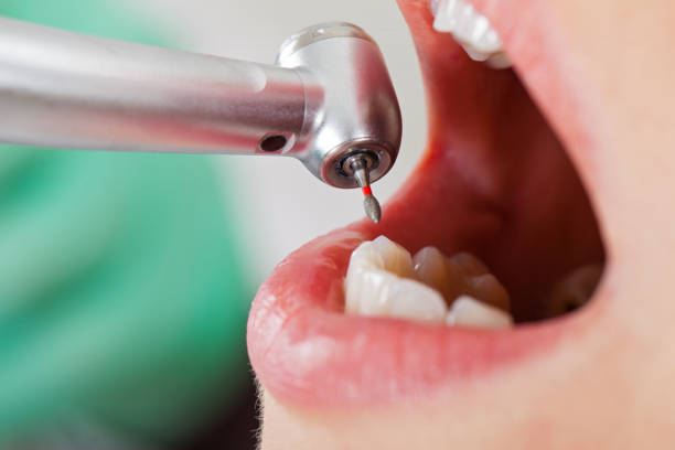 Best Emergency Wisdom Teeth Removal in Hazen, AR